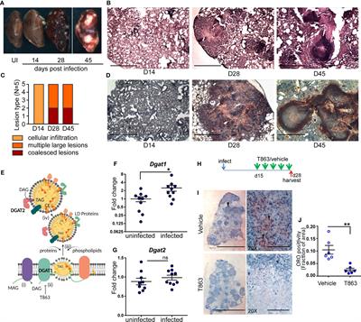 Inhibition of Granuloma Triglyceride Synthesis Imparts Control of Mycobacterium tuberculosis Through Curtailed Inflammatory Responses